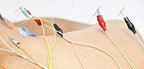 Electro Acupuncture Machine